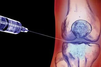 joint-injections-tampa-fl