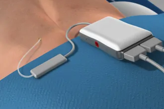 spinal-cord-stimulation-tampa-fl