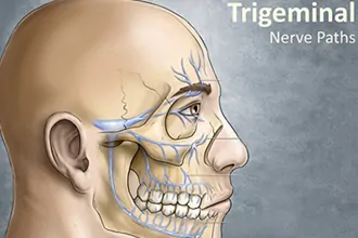 trigeminal-nerve-blocks-and-neurolysis-tampa-fl