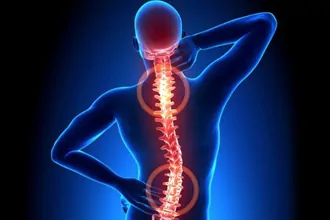 vertebroplasy-kyphoplasty-tampa-fl