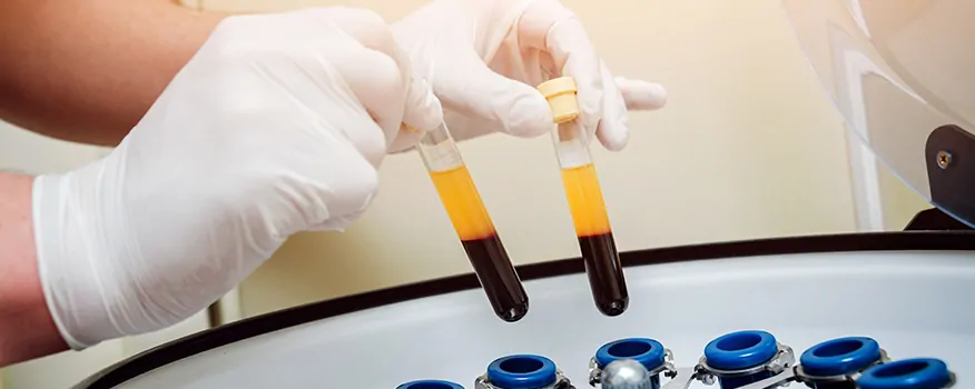 platelet-rich-plasma-tampa